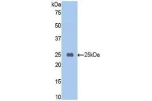 Detection of Recombinant TAFI, Mouse using Polyclonal Antibody to Carboxypeptidase B2 (CPB2) (CPB2 Antikörper  (AA 187-327))