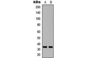 Western blot analysis of Carbonic Anhydrase 8 expression in MCF7 (A), NS-1 (B) whole cell lysates. (CA8 Antikörper  (Center))