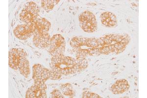 Immunohistochemistry (IHC) image for anti-Mitogen-Activated Protein Kinase Kinase 2 (MAP2K2) (AA 1-50) antibody (ABIN7454013) (Rekombinanter MEK2 Antikörper  (AA 1-50))