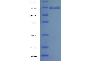 SDS-PAGE (SDS) image for Adaptor-Related Protein Complex 2, mu 1 Subunit (AP2M1) (AA 1-435), (full length) protein (His-SUMO Tag) (ABIN5709053)