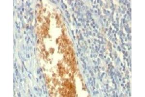 Formalin-fixed, paraffin-embedded human tonsil stained with AMPD3 antibody (AMPD3/901) (AMPD3 Antikörper)