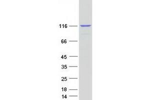 Validation with Western Blot (RASA1 Protein (Transcript Variant 1) (Myc-DYKDDDDK Tag))