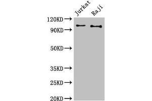 Western Blot Positive WB detected in: Jurkat whole cell lysate, Raji whole cell lysate All lanes: CBL antibody at 3 μg/mL Secondary Goat polyclonal to rabbit IgG at 1/50000 dilution Predicted band size: 100 kDa Observed band size: 100 kDa (CBL Antikörper  (AA 548-847))