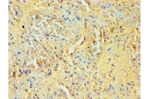 Immunohistochemistry of paraffin-embedded human lung tissue using ABIN7170995 at dilution of 1:100 (SOCS2 Antikörper  (AA 1-198))
