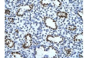 Rabbit Anti-ENO1 Antibody       Paraffin Embedded Tissue:  Human alveolar cell   Cellular Data:  Epithelial cells of renal tubule  Antibody Concentration:   4. (ENO1 Antikörper  (C-Term))