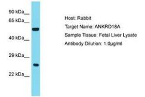 Image no. 1 for anti-Ankyrin Repeat Domain 18A (ANKRD18A) (AA 781-830) antibody (ABIN6750781) (ANKRD18A Antikörper  (AA 781-830))
