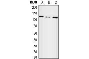 Western blot analysis of UBE4A expression in HepG2 (A), SP2/0 (B), H9C2 (C) whole cell lysates. (UBE4A Antikörper  (N-Term))