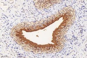 Immunohistochemistry analysis of paraffin-embedded rat bladder using,Uroplakin Ia (ABIN7076160) at dilution of 1: 4000