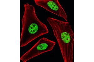 Fluorescent image of Hela cells stained with SP1 Antibody (ABIN1944791 and ABIN2838536). (SP1 Antikörper  (AA 1-250))