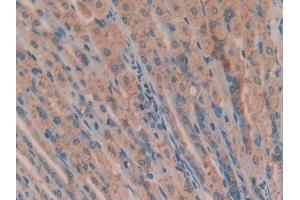 Used in DAB staining on fromalin fixed paraffin- embedded brain tissue (ANG Antikörper  (AA 25-145))