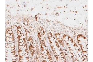IHC-P Image PNPase antibody detects PNPase protein at mitochondria on human normal colon by immunohistochemical analysis. (PNPT1 Antikörper)
