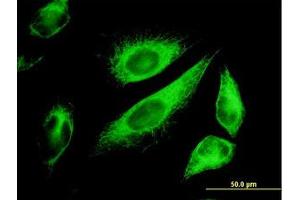 Image no. 5 for anti-Keratin 18 (KRT18) (AA 1-431) antibody (ABIN598778) (Cytokeratin 18 Antikörper  (AA 1-431))