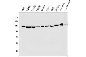 Western blot analysis of VCL using anti-VCL antibody (ABIN7599003).