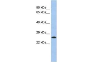 Western Blotting (WB) image for anti-MGC50273 antibody (ABIN2463949) (MGC50273 Antikörper)