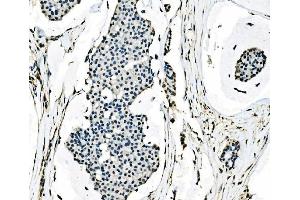 IHC analysis of splicing factor 1 using anti-splicing factor 1 antibody (ABIN7600194). (Splicing Factor 1 Antikörper  (AA 160-266))
