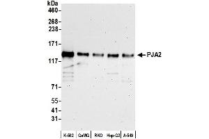 Western Blotting (WB) image for anti-Praja Ring Finger 2 (PJA2) (AA 150-200) antibody (ABIN7452215)