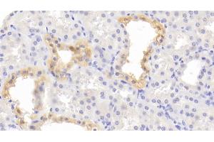 Detection of STAR in Human Kidney Tissue using Polyclonal Antibody to Steroidogenic Acute Regulatory Protein (STAR) (STAR Antikörper  (AA 1-285))