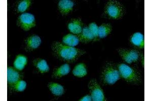 IF analysis of PDP1/PDP using anti-PDP1/PDP antibody (ABIN7601509). (PDP Antikörper  (AA 37-537))
