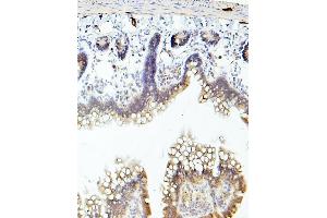 IHC analysis of TEK using anti-TEK antibody (ABIN7600762). (TEK Antikörper  (AA 23-616))