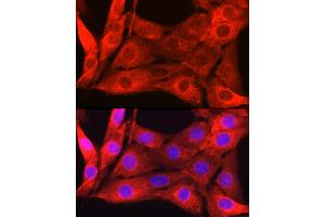 Immunofluorescence (IF) image for anti-Lectin, Galactoside-Binding, Soluble, 1 (LGALS1) (AA 1-135) antibody (ABIN6143156)