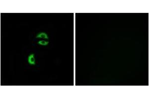 Immunofluorescence analysis of A549 cells, using LDLRAD3 Antibody. (LDLRAD3 Antikörper  (AA 37-86))