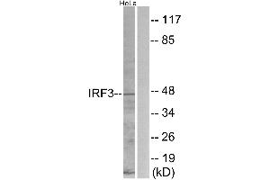 Immunohistochemistry analysis of paraffin-embedded human brain tissue using IRF3 (Ab-396) antibody. (IRF3 Antikörper  (Ser396))