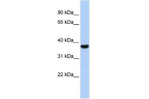 WB Suggested Anti-EXOSC2 Antibody Titration:  0. (EXOSC2 Antikörper  (Middle Region))