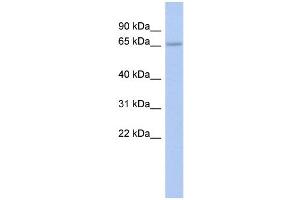 WB Suggested Anti-ZNF248 Antibody Titration:  0. (ZNF248 Antikörper  (Middle Region))