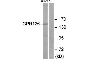 Western blot analysis of extracts from HUVEC cells, using GPR126 antibody. (G Protein-Coupled Receptor 126 Antikörper)