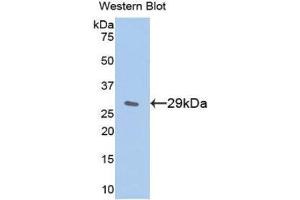 Western Blotting (WB) image for anti-Inhibitory Subunit of NF-KappaB epsilon (AA 207-440) antibody (ABIN3203929) (Inhibitory Subunit of NF-KappaB epsilon (AA 207-440) Antikörper)