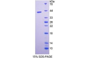 SDS-PAGE (SDS) image for Pepsinogen C (PGC) ELISA Kit (ABIN6574145)