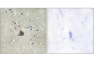 Immunohistochemistry analysis of paraffin-embedded human brain, using PLC beta3 (Phospho-Ser537) Antibody. (PLCB3 Antikörper  (pSer537))
