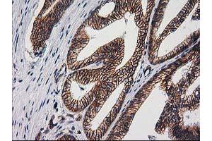 Image no. 2 for anti-Catenin (Cadherin-Associated Protein), beta 1, 88kDa (CTNNB1) antibody (ABIN1496894) (CTNNB1 Antikörper)