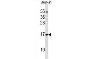 Western Blotting (WB) image for anti-Transcription Elongation Factor B (SIII), Polypeptide 1 (15kDa, Elongin C) (TCEB1) antibody (ABIN2998260) (TCEB1 Antikörper)