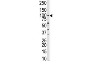 Western Blotting (WB) image for anti-PKN beta antibody (ABIN3003586) (PKN beta Antikörper)