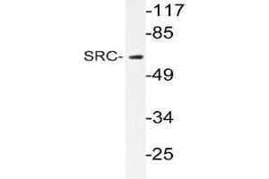 Western blot (WB) analyzes of SRC antibody in extracts from 293 cells. (NCOA1 Antikörper)