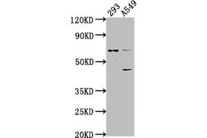 Western Blot Positive WB detected in: 293 whole cell lysate, A549 whole cell lysate All lanes: CRTAC1 antibody at 1:1000 Secondary Goat polyclonal to rabbit IgG at 1/50000 dilution Predicted band size: 72, 71, 69 kDa Observed band size: 72 kDa (CRTAC1 Antikörper  (AA 309-661))
