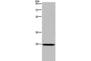 Western Blot analysis of Mouse spleen tissue using KLK14 Polyclonal Antibody at dilution of 1:300 (Kallikrein 14 Antikörper)