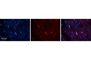 Rabbit Anti-MCM4 Antibody   Formalin Fixed Paraffin Embedded Tissue: Human heart Tissue Observed Staining: Nucleus Primary Antibody Concentration: 1:100 Other Working Concentrations: N/A Secondary Antibody: Donkey anti-Rabbit-Cy3 Secondary Antibody Concentration: 1:200 Magnification: 20X Exposure Time: 0. (MCM4 Antikörper  (Middle Region))