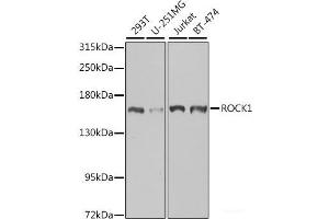 Western blot analysis of extracts of various cell lines using ROCK1 Polyclonal Antibody at dilution of 1:1000. (ROCK1 Antikörper)