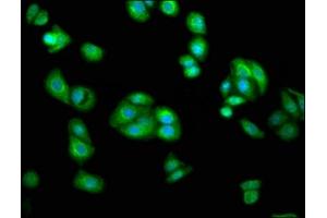 Immunofluorescence (IF) image for anti-Alanine Glyoxylate Aminotransferase 2 (AGXT2) (AA 196-328) antibody (ABIN7143624)