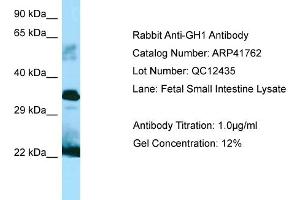 Western Blotting (WB) image for anti-Growth Hormone 1 (GH1) (C-Term) antibody (ABIN2776979)