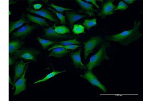 Immunofluorescence of purified MaxPab antibody to ST13 on HeLa cell.