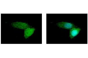 ICC/IF Image BSEP antibody [N3C1], Internal detects ABCB11 protein at membrane by immunofluorescent analysis.