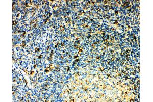 Anti-CCR3 antibody, IHC(P) IHC(P): Human Tonsil Tissue (CCR3 Antikörper  (N-Term))
