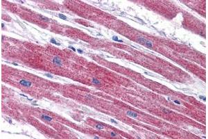 Immunohistochemistry (Formalin-fixed Paraffin-embedded Sections) (IHC (fp)) image for anti-NADH Dehydrogenase (Ubiquinone) 1 alpha Subcomplex, Assembly Factor 2 (NDUFAF2) (C-Term) antibody (ABIN605128)