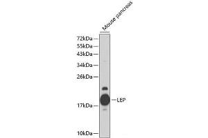 Western blot analysis of extracts of Mouse pancreas using LEP Polyclonal Antibody at dilution of 1:1000. (Leptin Antikörper)