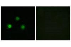 Immunofluorescence analysis of HUVEC cells, using MSH2 antibody. (MSH2 Antikörper)