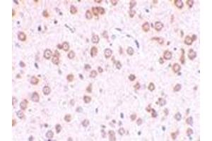 Immunohistochemistry of TLR5 in rat brain tissue with this product at 10 μg/ml. (TLR5 Antikörper  (Center))