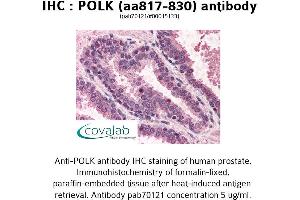 Image no. 1 for anti-Polymerase (DNA Directed) kappa (POLK) (AA 817-830) antibody (ABIN1738191) (POLK Antikörper  (AA 817-830))
